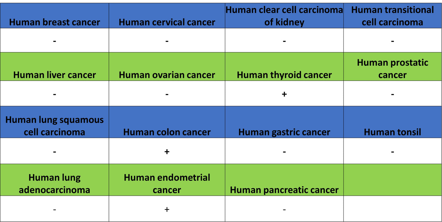 ATF-6 Recombinant Rabbit mAb (S-4366)