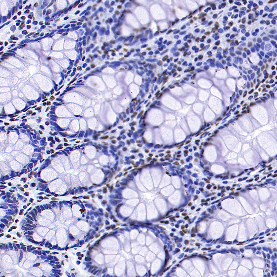 HNRNPA2B1 Mouse mAb