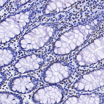 HNRNPA2B1 Mouse mAb