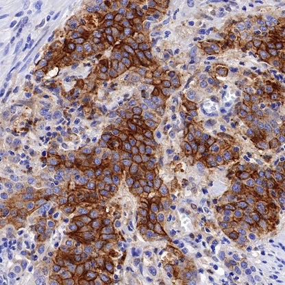 DFNA5/GSDME Recombinant Rabbit mAb (S-1703-1)