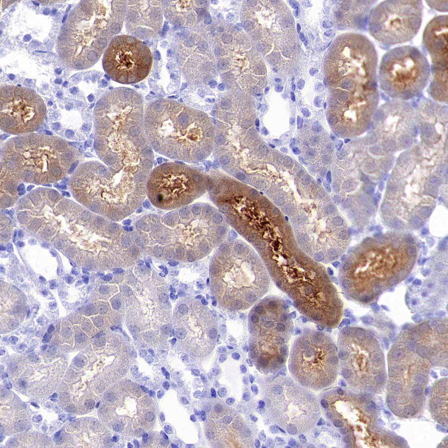 Pklr Recombinant Rabbit mAb (S-4114-40)