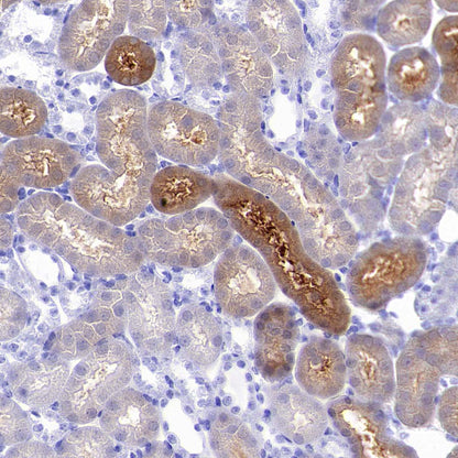 Pklr Recombinant Rabbit mAb (S-4114-40)
