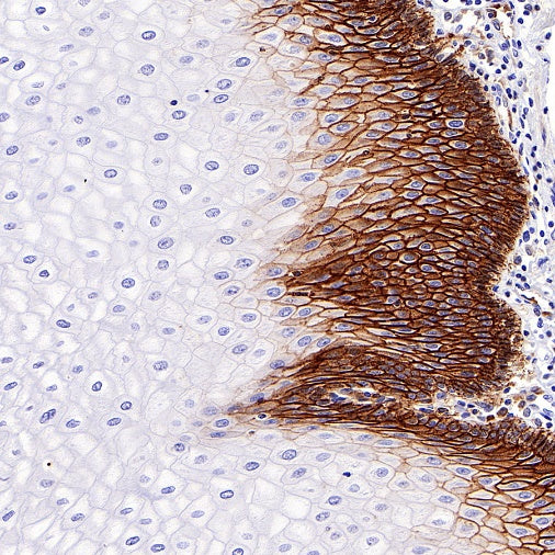 CD44v6 Mouse mAb (S-945-76)