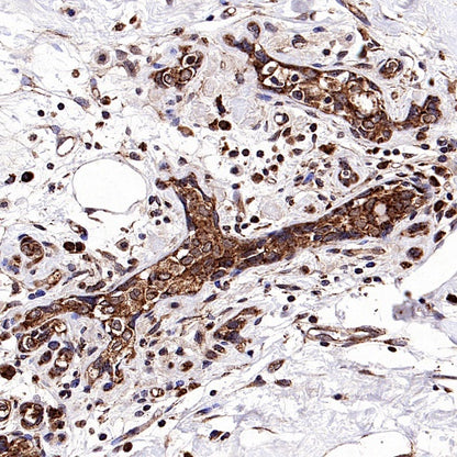 Fumarate hydratase Recombinant Rabbit mAb (SDT-2434-37)
