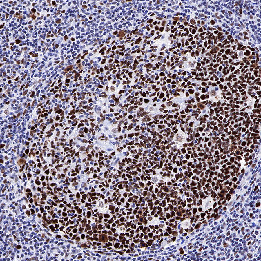 S-RMab® MSH6 Recombinant Rabbit mAb,PBS Only (SDT-R094)