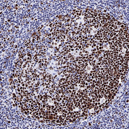 S-RMab® MSH6 Recombinant Rabbit mAb,PBS Only (SDT-R094)