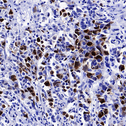 Aurora A Recombinant Rabbit mAb (S-5355)