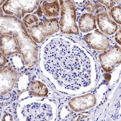p38α MAPK+p38β MAPK Recombinant Rabbit mAb (S-1300-102)