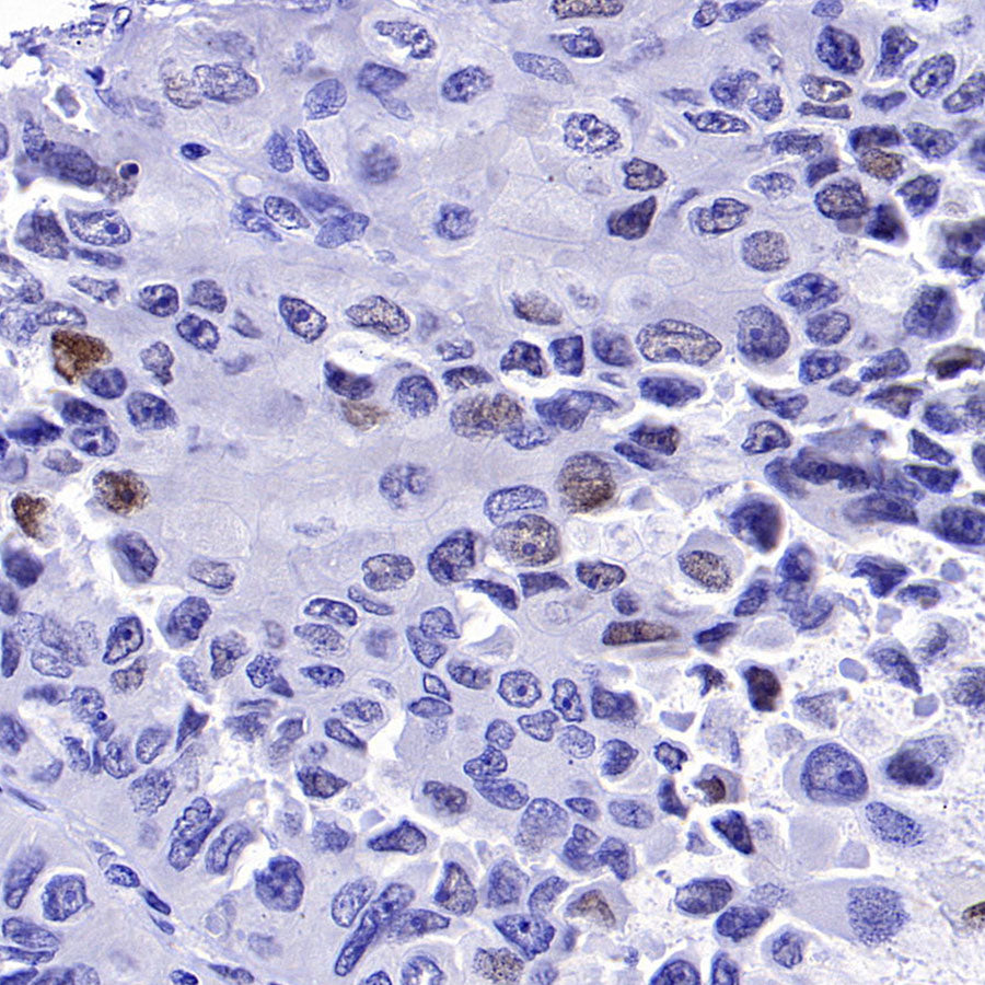 ATF3 Recombinant Rabbit mAb (S-3904)