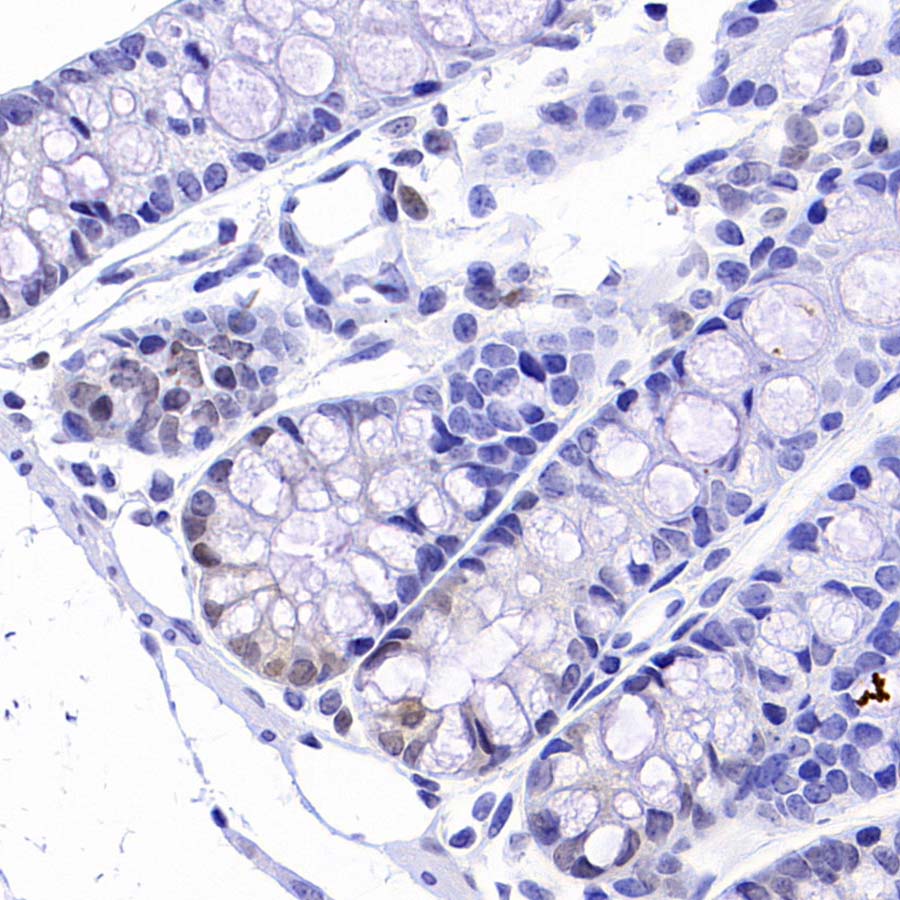 CDK6 Recombinant Rabbit mAb (S-4090-71)