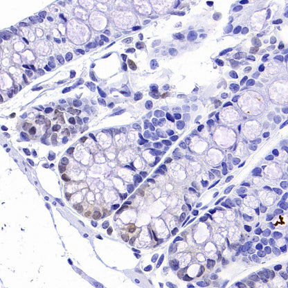 CDK6 Recombinant Rabbit mAb (S-4090-71)