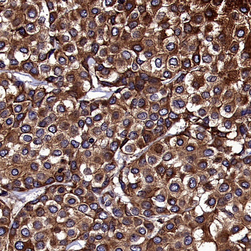 Calnexin Rabbit Polyclonal Antibody