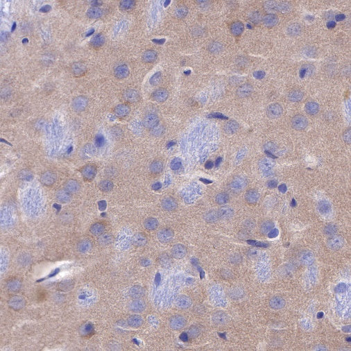 PSD-95 Recombinant Rabbit mAb (S-R311)