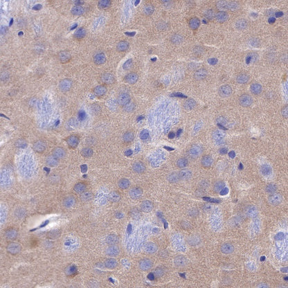 PSD-95 Recombinant Rabbit mAb (S-R311)