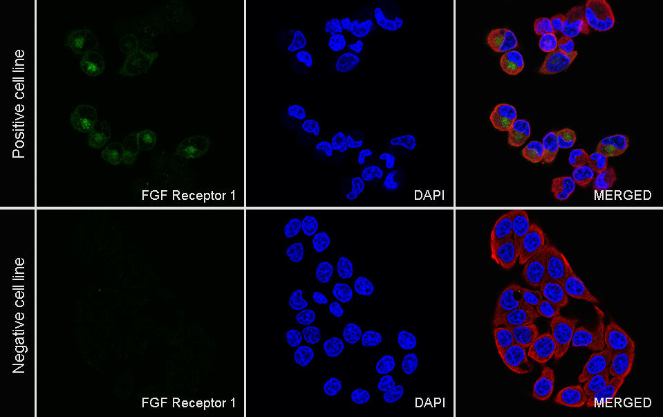 FGF Receptor 1 Recombinant Rabbit mAb (S-5668)