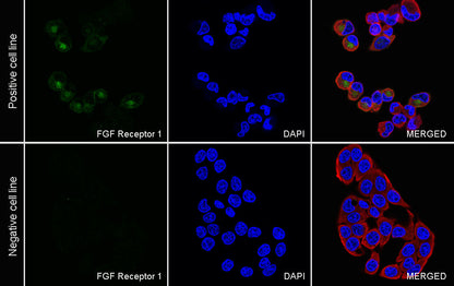 FGF Receptor 1 Recombinant Rabbit mAb (S-5668)