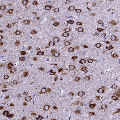 YTHDF1 Recombinant Rabbit mAb (S-2443-28)