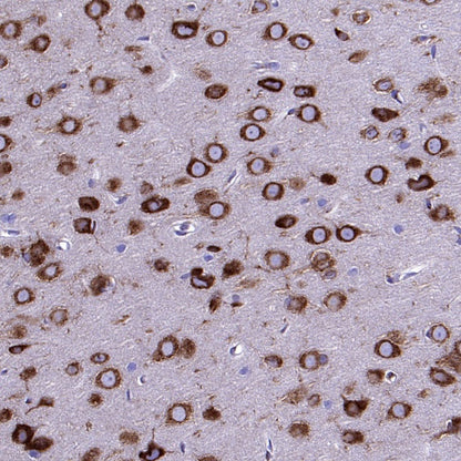 YTHDF1 Recombinant Rabbit mAb (S-2443-28)