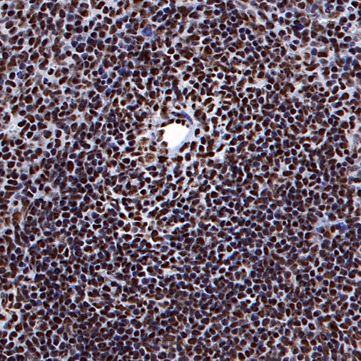 ARID1A Recombinant Rabbit mAb (S-440-62)