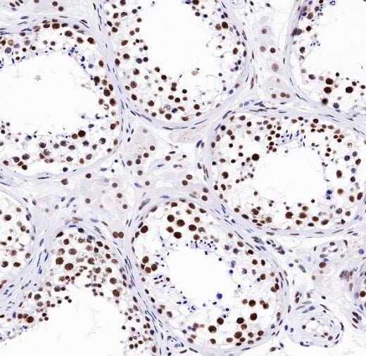 TDP-43 Recombinant Rabbit mAb (S-989-41)