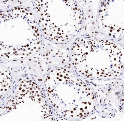 TDP-43 Recombinant Rabbit mAb (S-989-41)