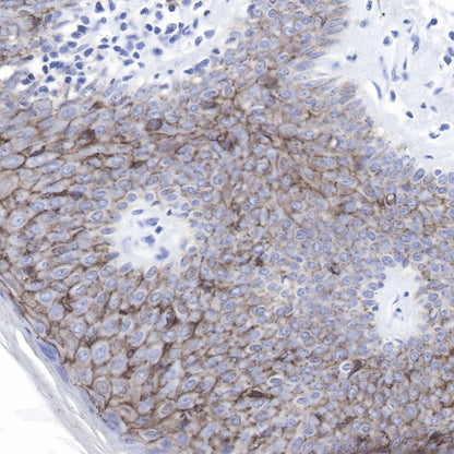 Claudin-1 Recombinant Rabbit mAb,PBS Only (SDT-R024)