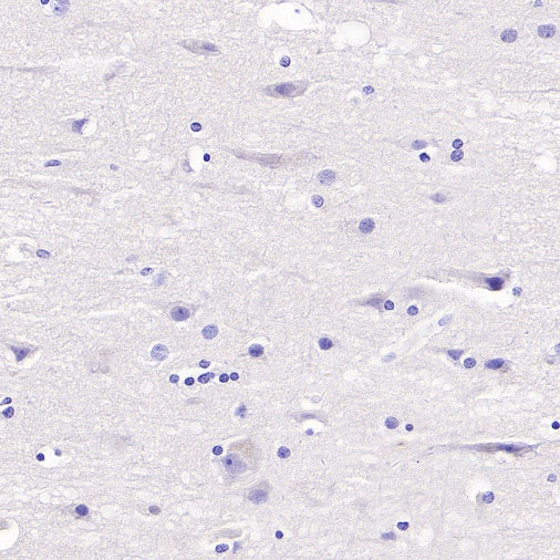 GDF3 Recombinant Rabbit mAb (S-3049-3)