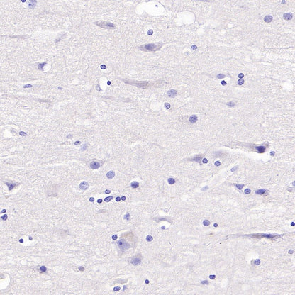 GDF3 Recombinant Rabbit mAb (S-3049-3)