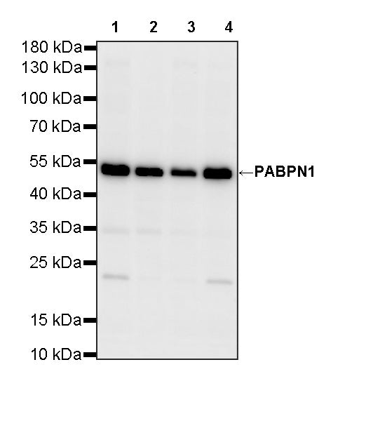 PABPN1 Rabbit Polyclonal Antibody