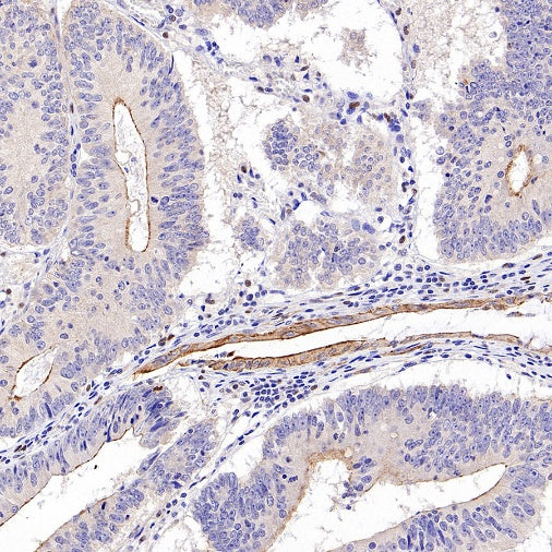 ZO-1 Recombinant Rabbit mAb (S-2188-12)
