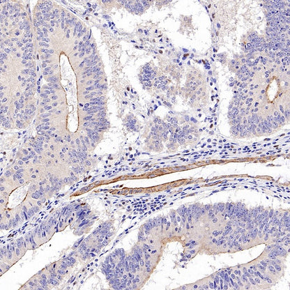 ZO-1 Recombinant Rabbit mAb (S-2188-12)