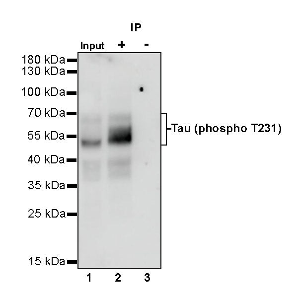 Tau (phospho T231) Recombinant Rabbit mAb (SDT-177-1)