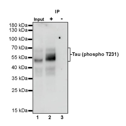 Tau (phospho T231) Recombinant Rabbit mAb (SDT-177-1)