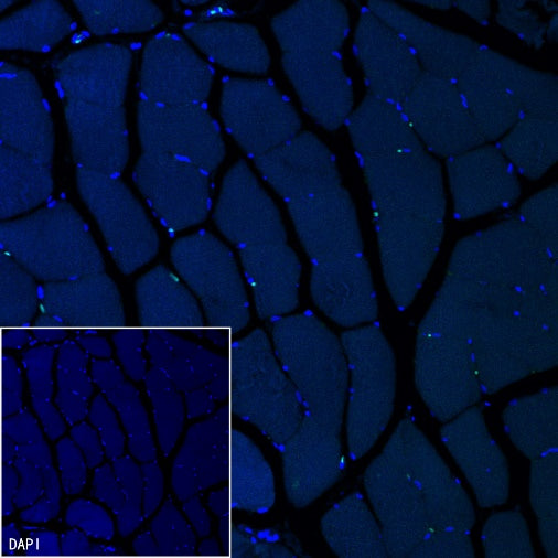 Cardiac troponin T (TNNT2) Recombinant Rabbit mAb (SDT-2894-34)