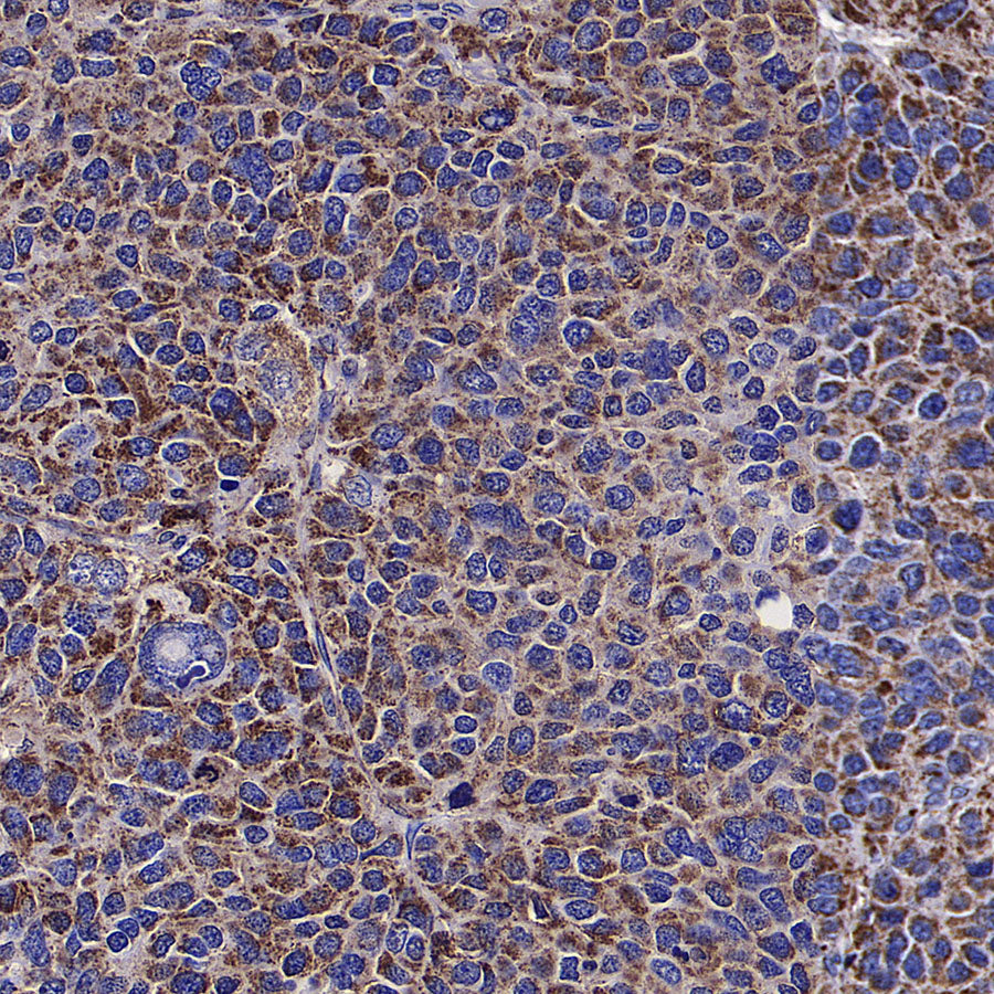 PDHE1 Alpha Mouse mAb