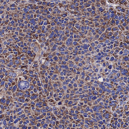 PDHE1 Alpha Mouse mAb