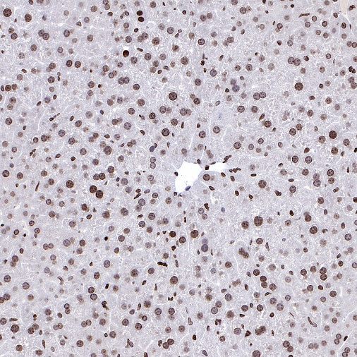 Histone H3 (di methyl K56) Recombinant Rabbit mAb (S-R427)