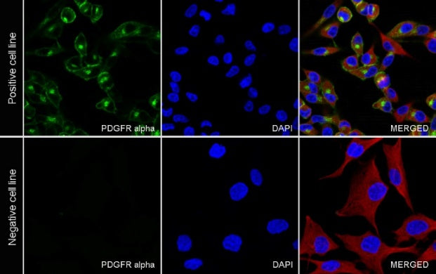 PDGFR alpha Recombinant Rabbit mAb (SDT-3353)