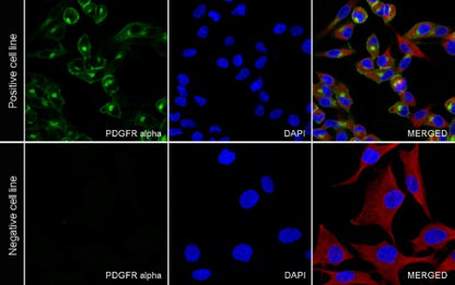 PDGFR alpha Recombinant Rabbit mAb (SDT-3353)