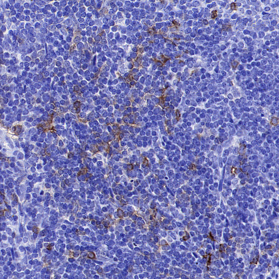 CD134 Recombinant Rabbit mAb (S-4797)