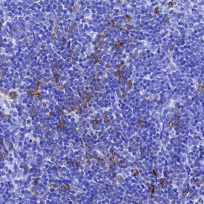 CD134 Recombinant Rabbit mAb (S-4797)