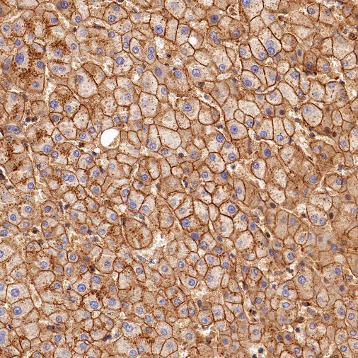 Flotillin 1 Rabbit Polyclonal Antibody