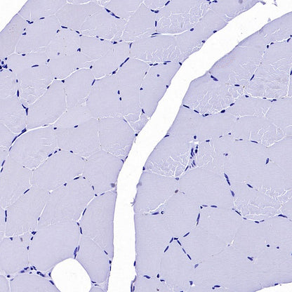Cardiac troponin T (TNNT2) Recombinant Rabbit mAb (SDT-2894-34)