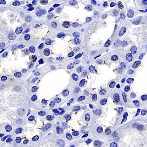 ARL13B Recombinant Rabbit mAb (S-2113-11)