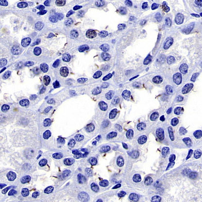 ARL13B Recombinant Rabbit mAb (S-2113-11)