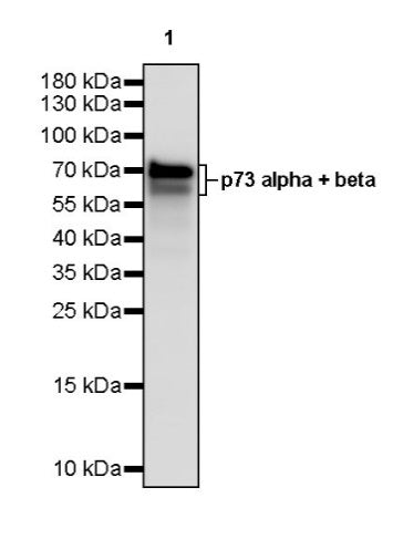 p73 alpha + beta Recombinant Rabbit mAb (S-2565-27)