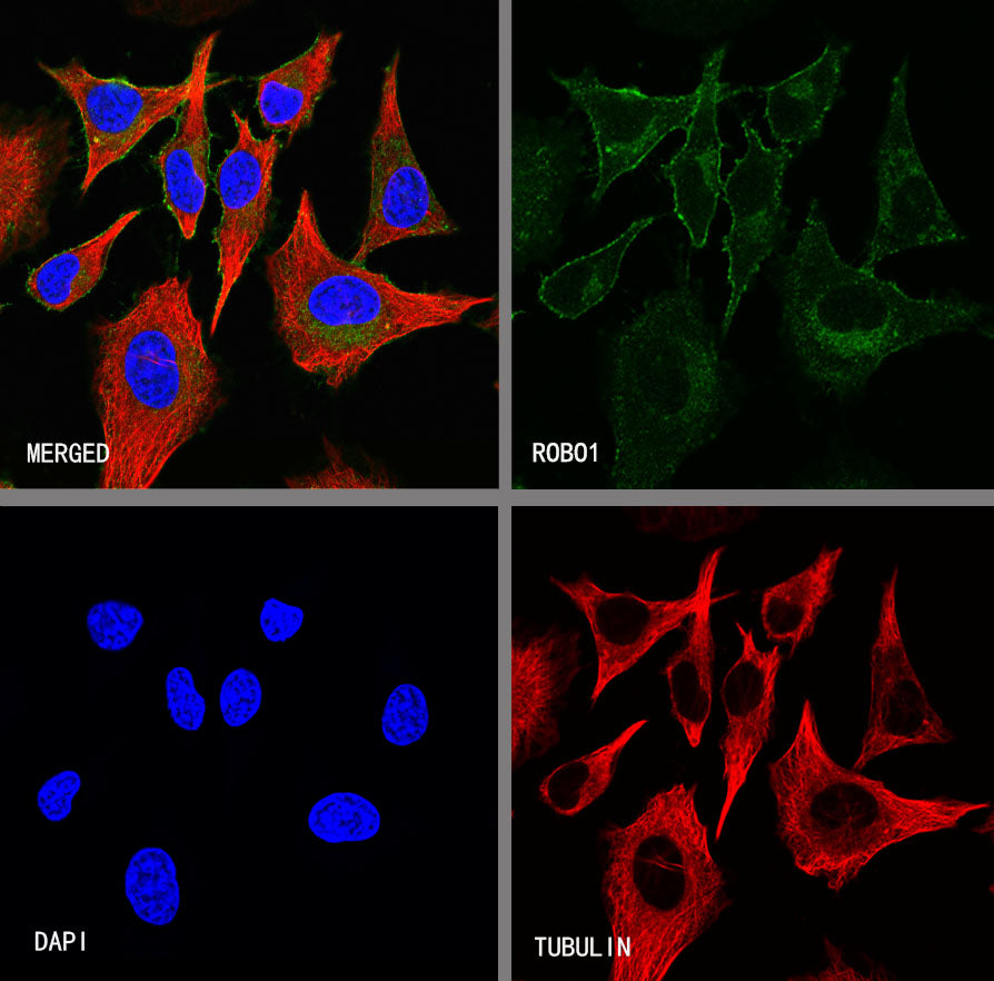 ROBO1 Recombinant Rabbit mAb (S-2931-169)