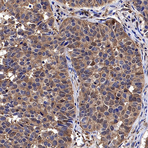 YWHAH/14-3-3 eta Recombinant Rabbit mAb (S-1327-22)