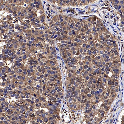 YWHAH/14-3-3 eta Recombinant Rabbit mAb (S-1327-22)