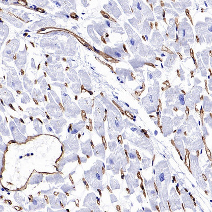 PODXL Recombinant Rabbit mAb (S-2014-9)